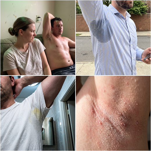 Quatro fotos de axila e camisa manchada por desodorante comum