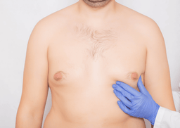 Desequilíbrio Hormonal